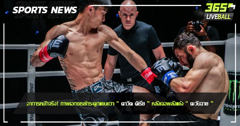 อาการหนักจริง! ภาพเอกซเรย์กระดูกแขนขวา “ ดาวิต คิเรีย ” หลังเจอพลังแข้ง “ ตะวันฉาย ”